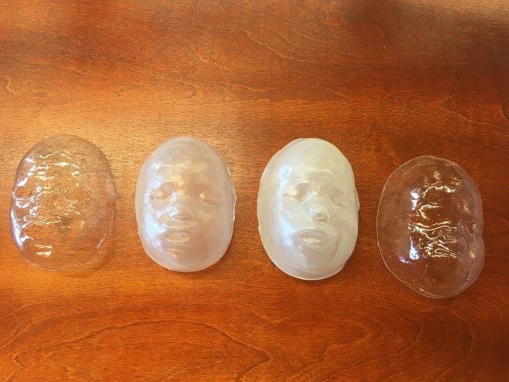 Transparent mask for facial treatment after a burn
